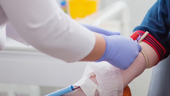 医生分析“19岁少年生前被连续抽血浆16次”，献血浆会不会有生命危险？
